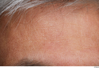 HD Face Skin Reuben Panjaitan face forehead skin pores skin…